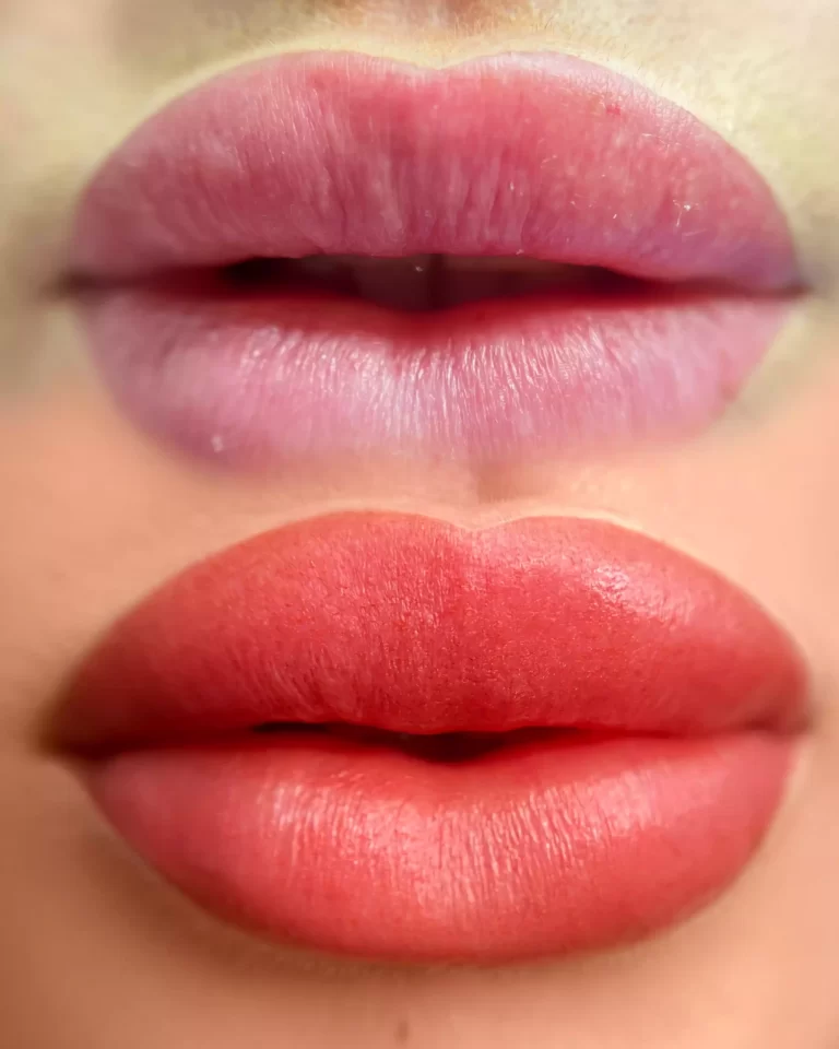 Lip blush treatment
