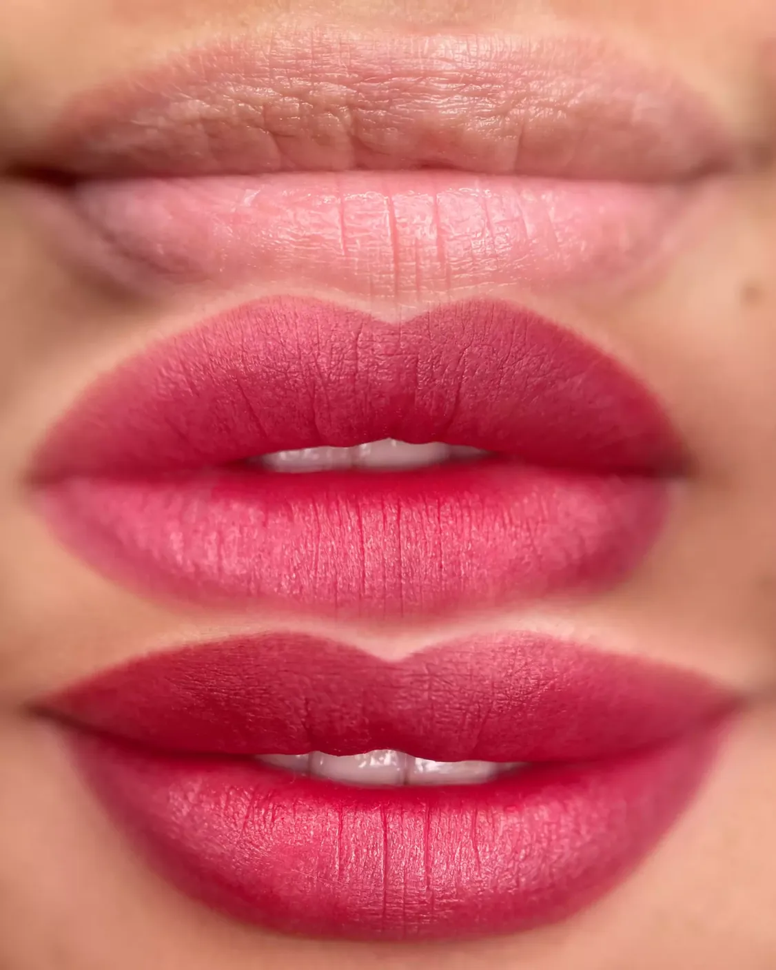 Lip blush treatment