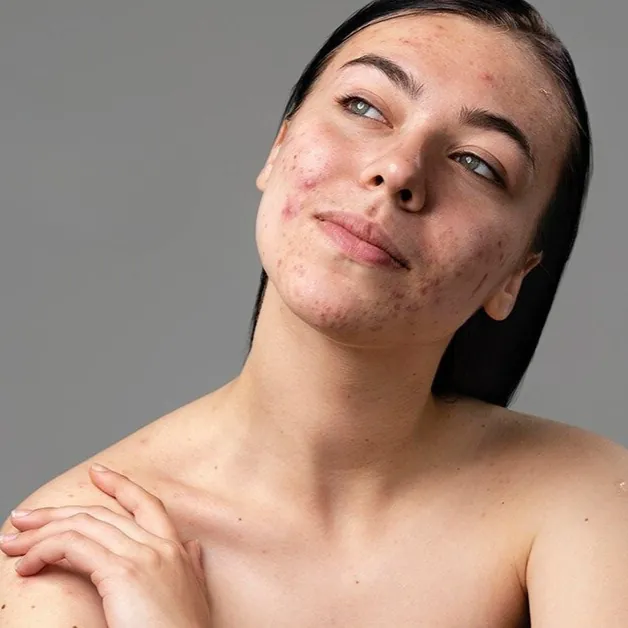 Skin Conditions and Brow Tattooing at Brows and Lips
