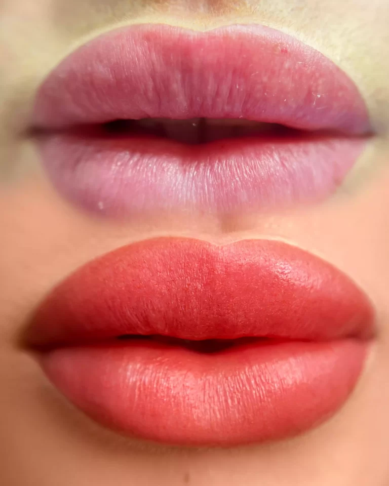 Lip Blush Treatment