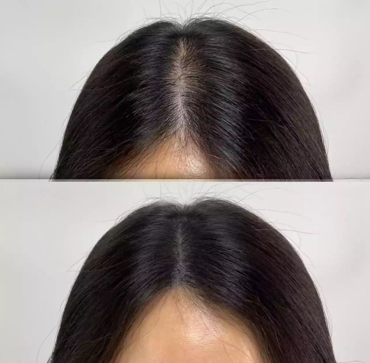 Kopfhaut-Tarnung: Alles, was Sie über Haartattoos wissen müssen