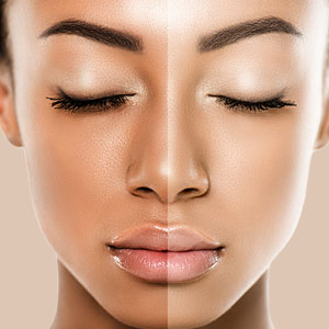 Skin Brightening Facial by Brows & Lips